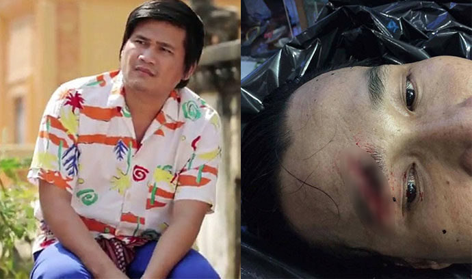 ពែកមី ខឹងគេចុះផ្សាយថា នាយ គ្រឿន រងរបួស ព្រោះត្រូវគេដេញកាប់រយះក្បាលដេរ ១០ ថ្នេរ