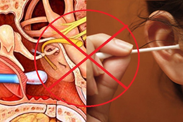 ផលប៉ះពាល់នៃការសម្អាតត្រចៀកដែលអ្នកមិនធ្លាប់ដឹង