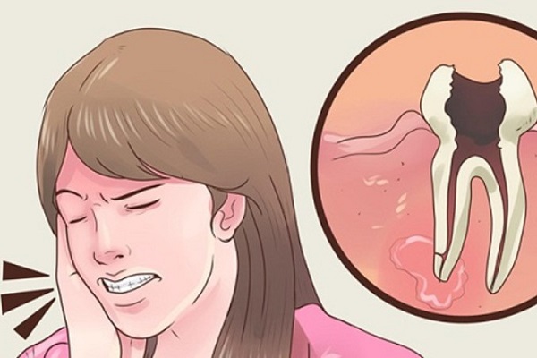 វិធី5យ៉ាង​ជួយ​បន្ថយ​អាការ​ឈឺធ្មេញ​