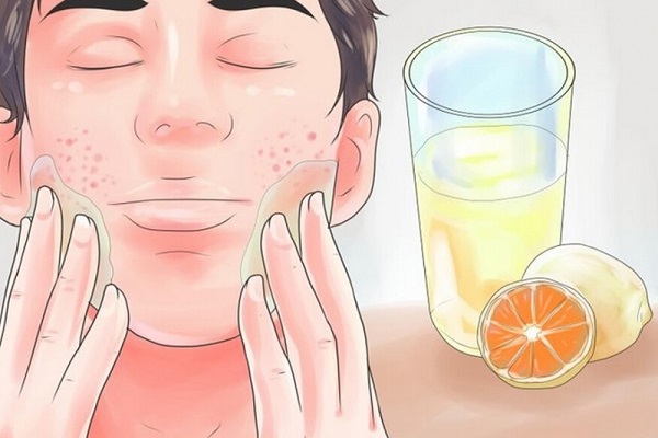 ស្លាកស្នាមក្រោយកើតមុនអាចបំបាត់បានទេ?