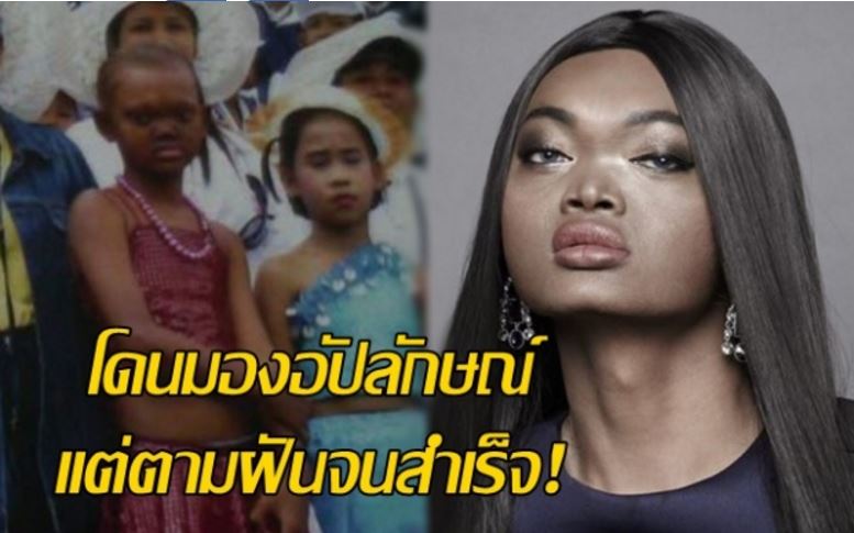 តារាកំប្លែងមុខអាក្រក់ជាងគេនៅប្រទេសថៃ បានសម្រេចក្ដីស្រមៃមួយហើយ​…