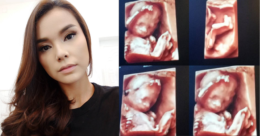 សូមចូលរួមត្រេកអរផងណា៎ VJ ANo !