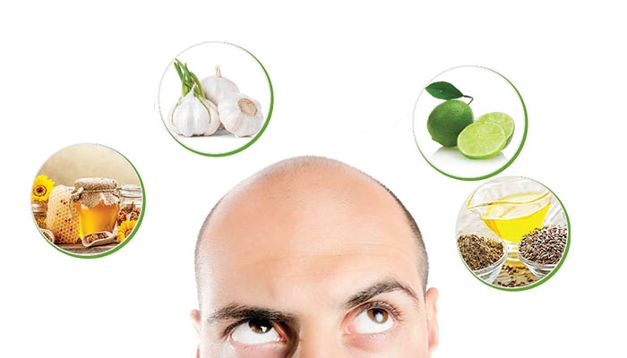 មានសង្ឃឹម​ហើយ! បុរស​ដែលមាន​បញ្ហា​សក់​ស្តើង និង​សក់​ទំពែក