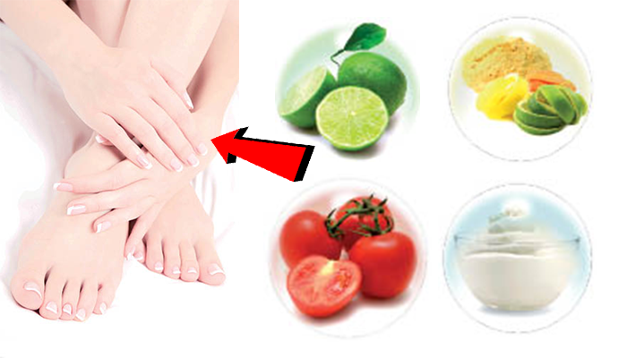 វិធីងាយៗបំបាត់ស្នាមខ្មៅជាំនៅលើស្បែកដៃ និងជើង