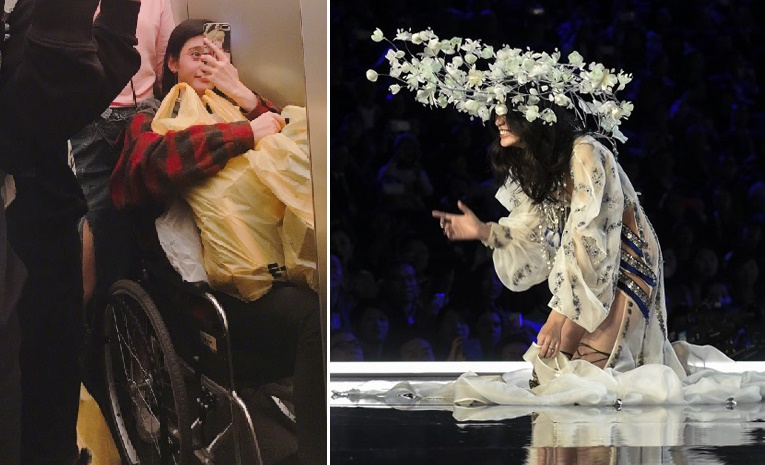 បន្ទាប់ពីភ្លាត់ស្នៀតរអិលដួលផ្កាប់មុខ នារីម៉ូដែលចិនបង្ហាញរូបភាពហើមកជើង