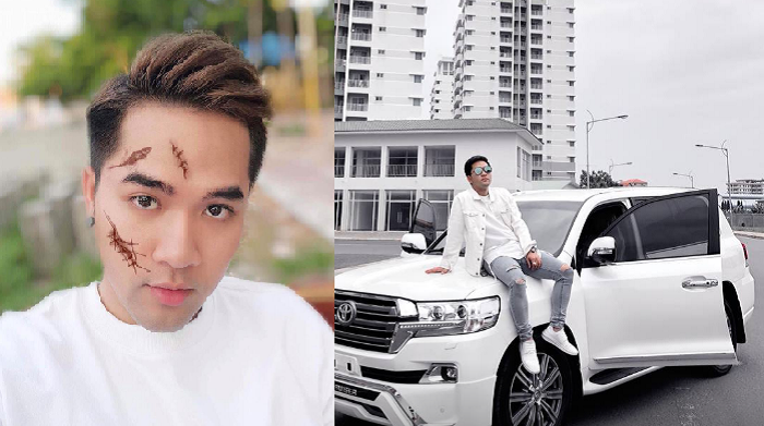 សុគន្ធ ថេរ៉ាយុ បញ្ចេញរថយន្ដប្រណីតភ្លាម ប៉ះសម្ដីជាមួយអ្នកលេងហ្វេសប៊ុកភ្លែត