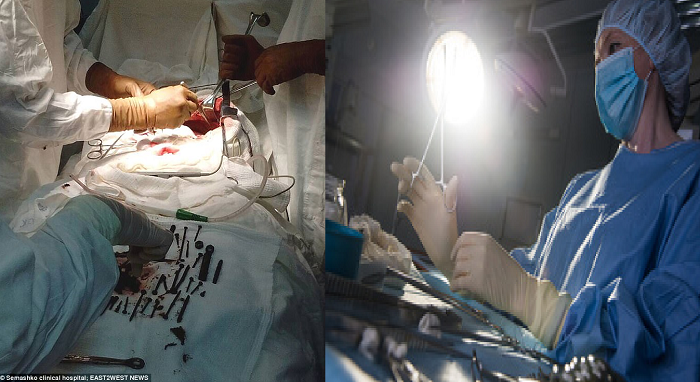 ស្ត្រីវ័យចំណាស់ញៀនហូបដែកគោល ដើម្បីបន្ថែមជាតិដែកក្នុងខ្លួន