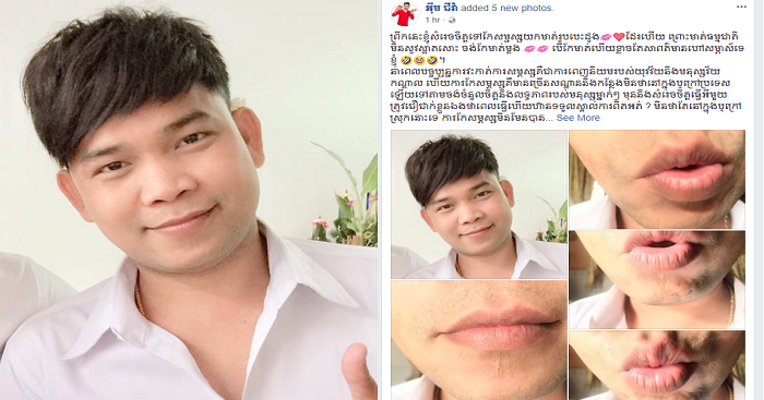 អីយ៉ា !! អ៊ឺម ជីវ៉ា ប្រកាសសម្រេចចិត្តទៅកែសម្ផស្សយកមាត់រូបបេះដូង