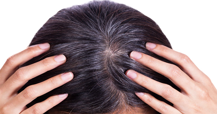 មែនឬ… សក់ស្កូវ រឹតតែដក រឹតតែច្រើនឡើង?