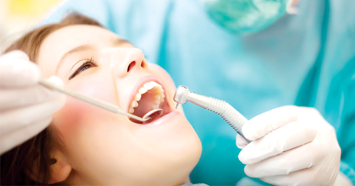 ហេតុ​អី​ត្រូវ “សម្អាតកំណកកំបោរ” ចេញពី​ធ្មេញ?