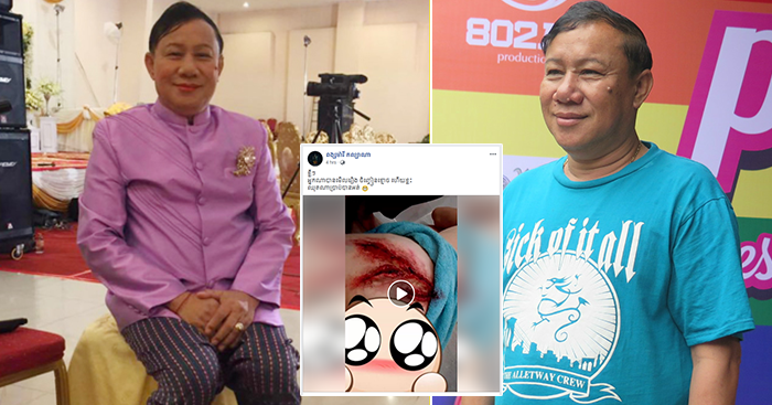 ទស្សនាការធ្វើស្នាមរបួសក្លែងក្លាយលើសាច់គូទលោកពូ សាន ម៉ៅ ក្នុងរឿង «ចិញ្ចៀនខ្មោច»