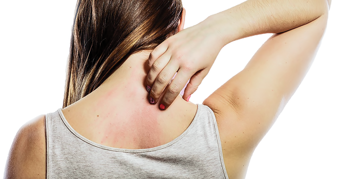 ឱសថ​បុរាណ4ប្រភេទ​ ជួយ​ព្យាបាល​អាការ​រមាស់​យ៉ាង​ពូកែ​ស័ក្តិសិទ្ធិ