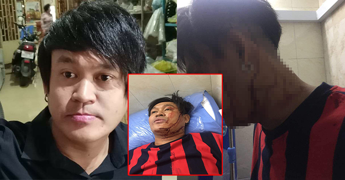 អាន​ ​វិសាល​ ​ត្រូវ​ក្រុម​ក្មេង​ស្ទាវ​ព្រួត​គ្នា​វាយ​មួយ​ញញួរ​បែកក្បាល​ ​បែរជា​សុខចិត្ត​សំងំ​ស្ងៀម​លាក់​ព័ត៌មាន​