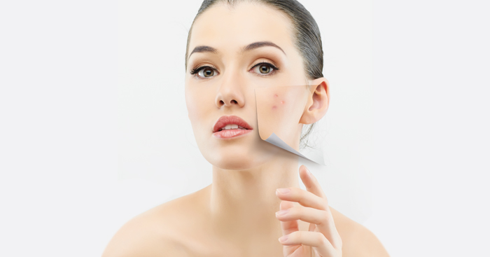 វិធី​ព្យាបាល​សន្លាក​ក្នុង​រយៈពេល​ខ្លី​បំផុត