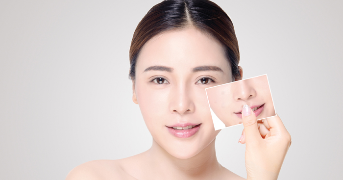 អនុវត្ត​តាមវិធី​ទាំងនេះ​អាចម៍​រុយ​ថ្មី​ៗនឹង​កម្ចាត់​បាន​យ៉ាង​ងាយ​