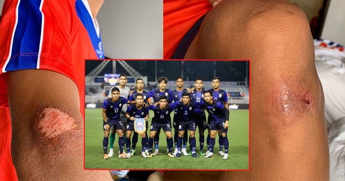 កីឡាករ​ស្នូល​ ​2នាក់​របស់​កម្ពុជា​ ​រង​របួស​មុន​ពេល​ជួប​ទីម័រខាងកើត​