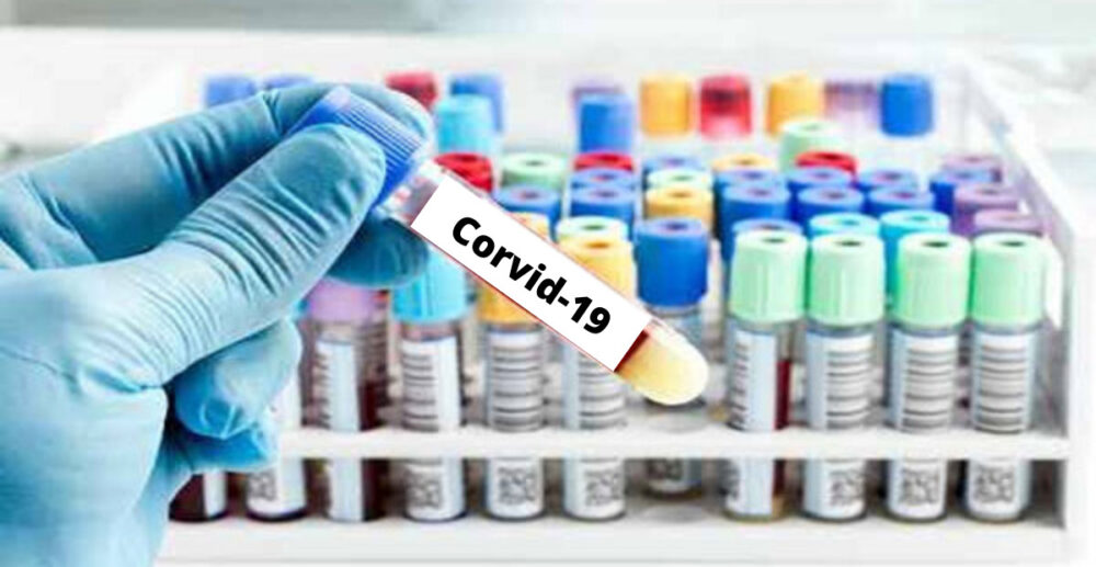 ដំណឹងល្អពីអឺរ៉ូប! អង់គ្លេសពិសោធវ៉ាក់សាំងថ្មី ទប់ស្កាត់វីរុសកូរ៉ូណា “Corvid-19″