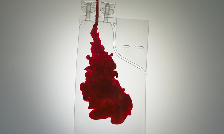 ប្លាស្មាឈាមរបស់អ្នកជាពីជំងឺកូរ៉ូណា អាចកម្ចាត់មេរោគ Covid-19!