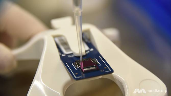 ឧបករណ៍តេស្តថ្មីនៅសិង្ហបុរី អាចស្វែងរកលទ្ធផល COVID-19 បានរហ័ស