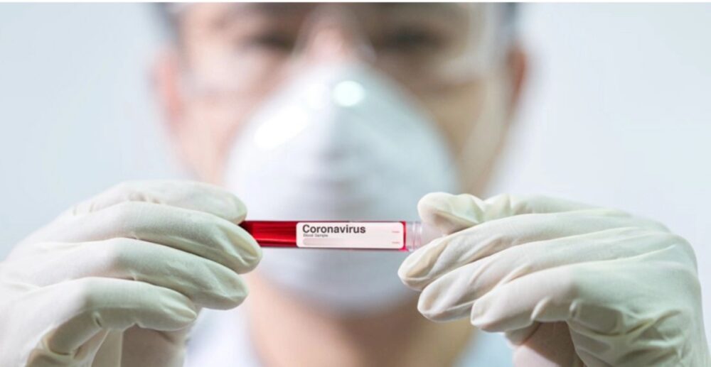 គ្រូពេទ្យជំនាញថៃ និយាយថា វីរុសកូវីដ-19នៅប្រទេសអ៊ីតាលី ជាប្រភេទវីរុសកាចសាហាវ…