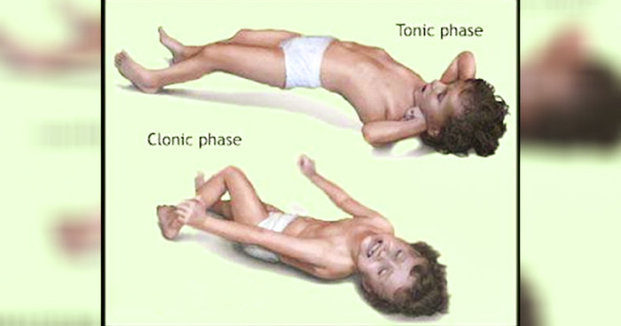 ត្រូវប្រយ័ត្ន និងត្រូវដឹង អាការប្រកាច់ដែលបណ្តាលមកកូនតូចក្តៅខ្លួនខ្លាំង