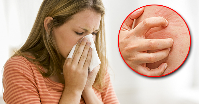 ឆ្លើយតបចំណុចសង្ស័យ ហេតុអីបានយើងកើតរោគប្រតិកម្មចាញ់?