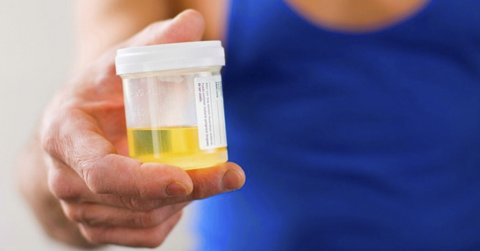 រឿងរបស់ទឹកមូត្រដែលពាក់ព័ន្ធនឹងសុខភាព