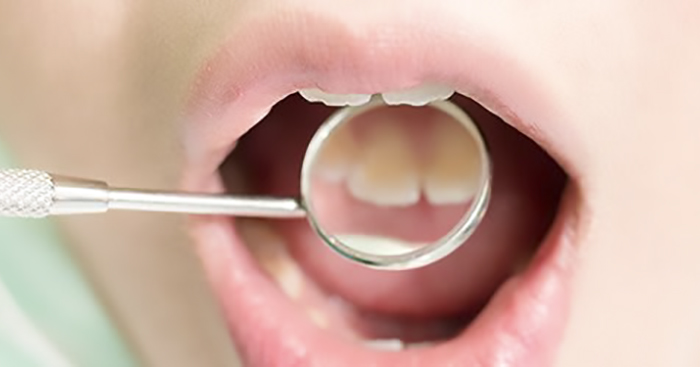 ពិនិត្យមើលធ្មេញរបស់អ្នកថា តើត្រូវជាតិអាស៊ីតកាត់រេចរិលអស់ប៉ុន្មានហើយ?