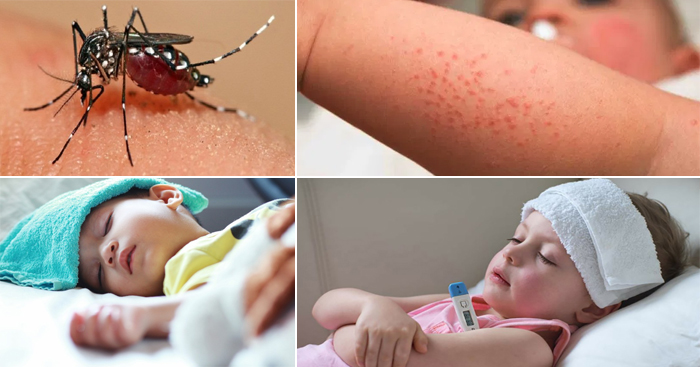 វិធីសង្កេតអាការជំងឺគ្រុនឈាម