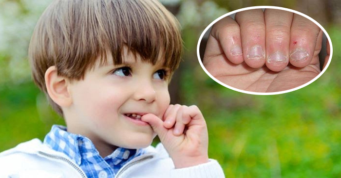 5 វិធី កែបញ្ហាកូនខាំក្រចកដៃ គួរតែបញ្ឈប់ទង្វើនេះមុនក្លាយជាទម្លាប់