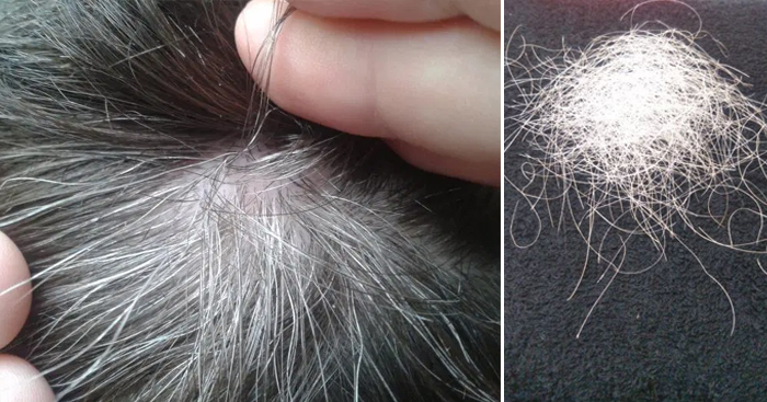 មែនឬ…សក់ស្កូវ រឹតតែដក រឹតតែច្រើនឡើង?