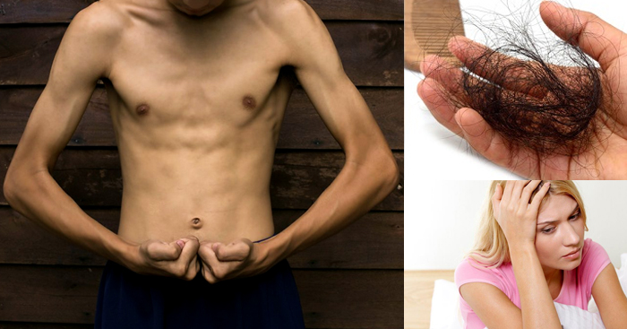 ពិនិត្យខ្លួនឯងទៅមើល៍…តើអ្នកគួរទទួលទាន “វីតាមីនបន្ថែម” ឬទេ?