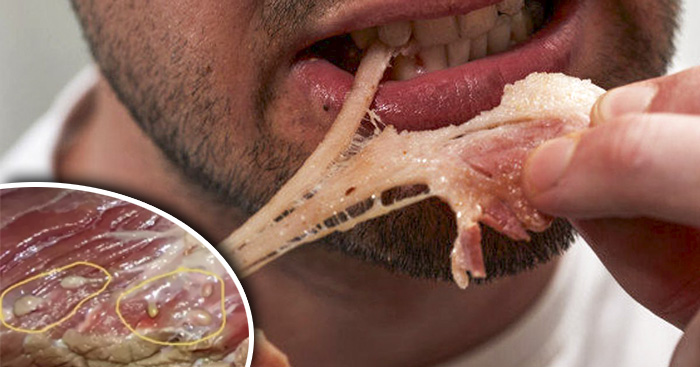 នាំគ្នាមកស្គាល់ពី សត្វល្អិត ឬព្រូនក្នុងសាច់ជ្រូក តើមានគ្រោះថ្នាក់ដល់រាងកាយមនុស្សឬទេ?