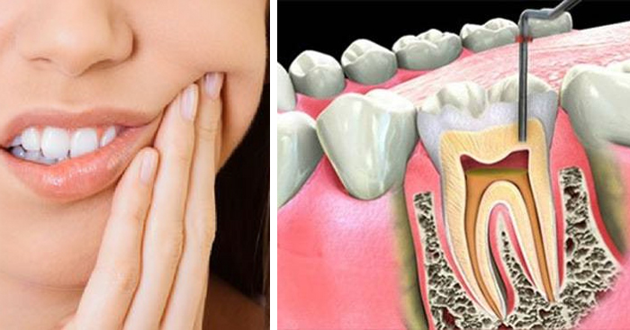 7 សញ្ញាគ្រោះថ្នាក់ដែលប្រាប់ថា ដល់ពេលព្យាបាល “ឫសធ្មេញ” ហើយ