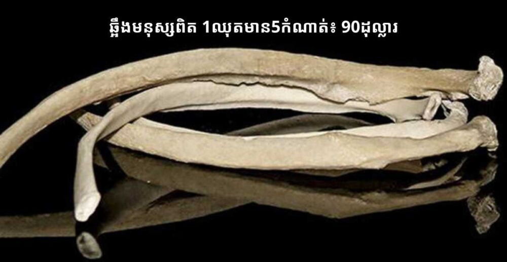 ឆ្អឹងមនុស្ស​ពិត​គឺ​ជា​មុខ​ទំនិញ​ដ៏​ចម្លែក​មួយ​ដែល​លក់​ដាច់​ជាង​គេ​នៅ​លើ​ផ្សារ​ Amazon