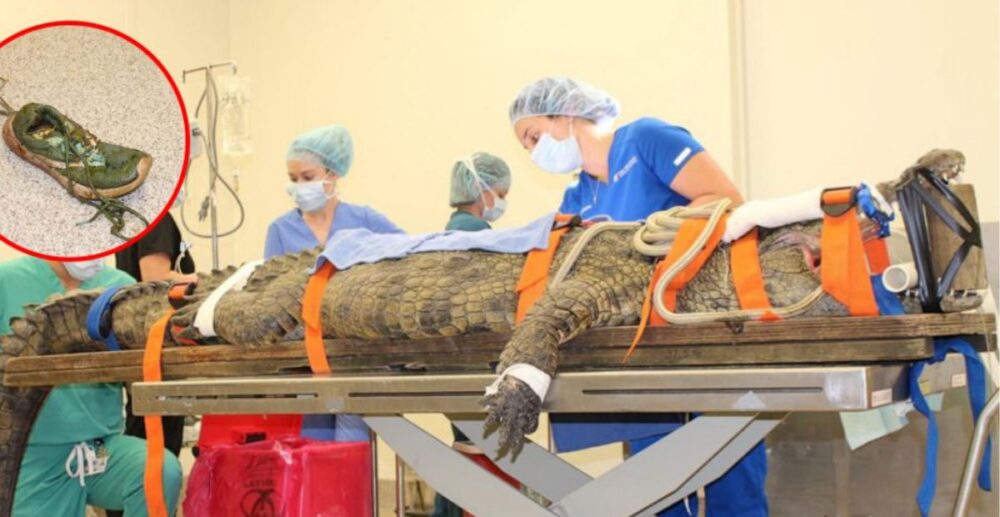 ក្រពើ​យក្ស ឡើង​ជ្រញ់​វះកាត់ ក្រោយពី​ភ្លេចខ្លួន ច្រឡំ​លេប​ស្បែកជើងបាតា ចូល​ពោះ