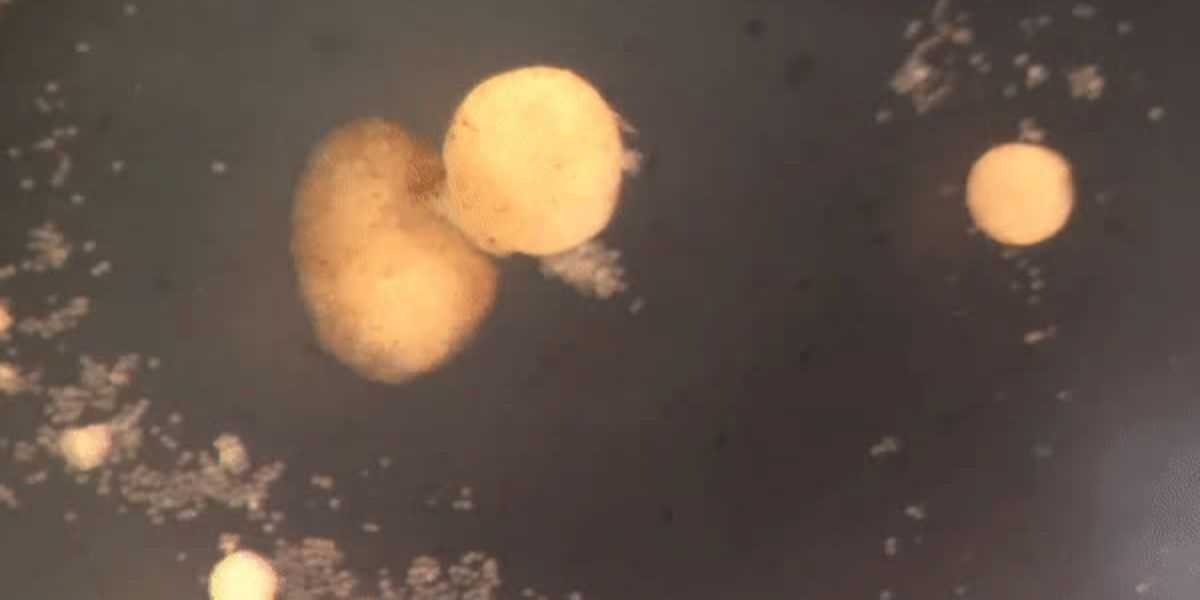 (វីដេអូ)-រ៉ូ​បូត​មានជីវិត «xenobot» ដែល​បង្កើតឡើង​អំពី​កោសិកា​កង្កែប បានចាប់ផ្ដើម​រស់ និង​បង្កើត​កូនចៅ​ដោយ​ខ្លួនឯង