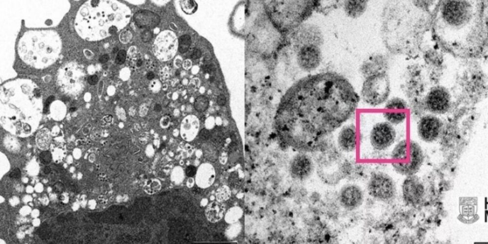 អង្គ​ប​ដិ​ប្រាណ​ «ចាស់វស្សា» ដែល​អាច​កម្ចាត់​ទាំង អូ​មី​ក្រុង ទាំង​​​បណ្ដា​វ៉ា​រ្យ៉​ង់ នាពេល​អនាគត របស់ ​កូ​វីដ-១៩