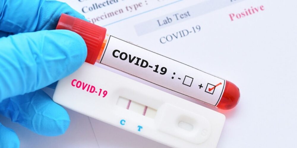 មន្ត្រី​​របស់​ សហរដ្ឋ​អាម៉េរិក ថ្លែង​ថា ឧបករណ៍​ធ្វើតេស្ត​រហ័ស​លក្ខណៈ​​គ្រួសារ អាច​បង្ហាញ​លទ្ធផល «អវិជ្ជមាន​​ក្លែង​ក្លាយ»​ ចំពោះ អូ​មី​ក្រុង