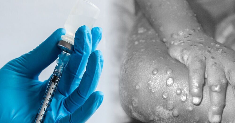 សហរដ្ឋ​អាម៉េរិក បង្កើន​ការទិញ​វ៉ាក់សាំង​បង្ការ​ជំងឺ​អុត​ស្វា (Monkeypox)