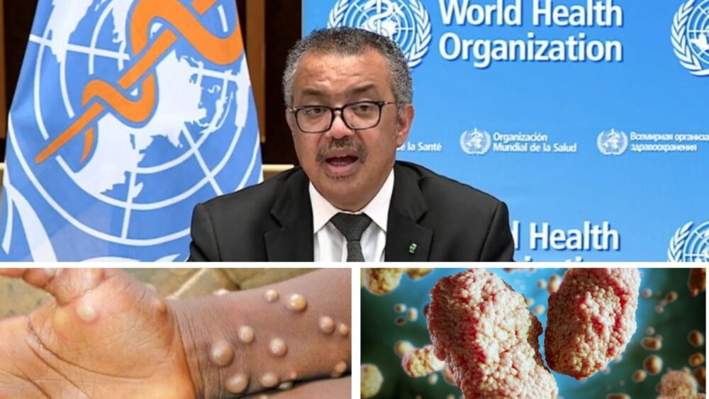 ប្រធានអង្គការសុខភាពពិភពលោក (WHO) ព្រមានអំពីការឆ្លងរាលដាលនៃជំងឺអុតស្វា នៅទូទាំងសកលលោក