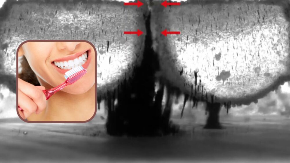 «កងទ័ព​ច្រាស​ដុសធ្មេញ​រ៉ូ​បូត​មហា​ល្អិត» អាច​សម្អាត​ធ្មេញ និង​បាត់​តេ​រី​អាក្រក់​គ្រប់​កន្លុក​កន្លៀក​លើ​ធ្មេញ​មនុស្ស (វីដេអូ)