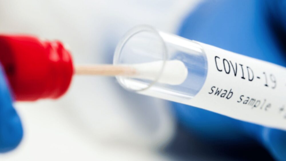 ស្ថានភាព​ជំងឺ​កូវីដ-១៩ នៅ​ កម្ពុជា គិត​ត្រឹម​វេលា​ទៀប​ភ្លឺ​ ​ថ្ងៃទី ១៥ ខែ​កក្កដា ២០២២