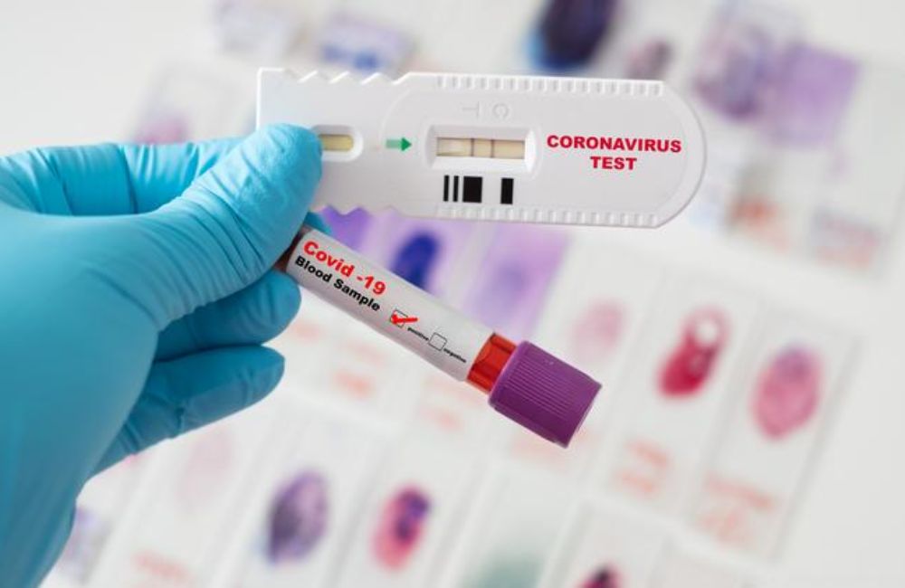 ស្ថានភាព​ជំងឺ​កូវីដ-១៩ នៅ​ កម្ពុជា ប្រកាសនៅ​​ក្នុង​​​​ថ្ងៃទី ២៣ ខែ​​កញ្ញា ២០២២