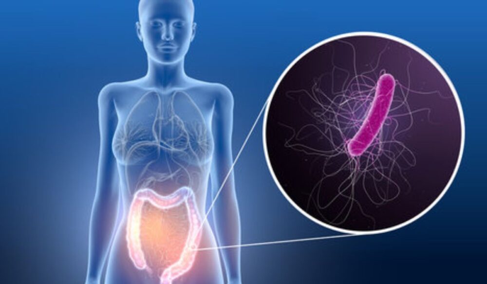 ឱសថ​អភិវឌ្ឍ​ពី​ «លាមក​មនុស្ស» ទទួលបាន​ការអនុម័ត​ឱ្យប្រើ​ប្រាស់​ពី សហរដ្ឋ​អាម៉េរិក